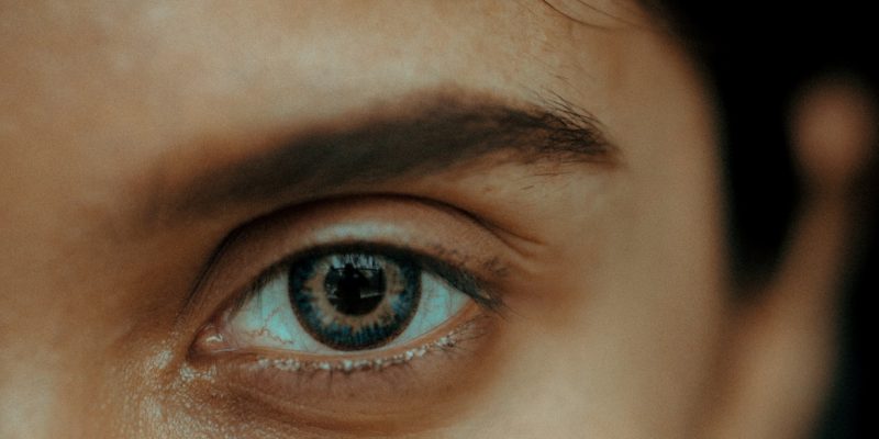 How rare are Sanpaku Eyes