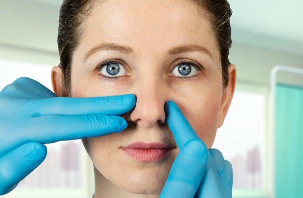 nose plastic surgery